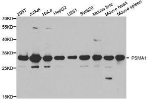 Western blot analysis of extracts of various cell lines, using PSMA1 antibody. (PSMA1 Antikörper  (AA 1-263))