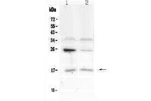 Western blot analysis of IL1F10 using anti-IL1F10 antibody . (IL1F10 Antikörper  (AA 1-152))