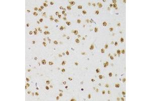 Immunohistochemistry of paraffin-embedded mouse brain using CSRP3 Antibody (ABIN2562048) at dilution of 1:100 (40x lens). (CSRP3 Antikörper)