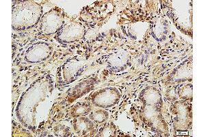 Formalin-fixed and paraffin embedded:  human gastric mucosa labeled with Anti-ET-1 Polyclonal Antibody, unconjugated  (ABIN726245)  at 1: 300, followed by incubation with conjugated secondary antibody and DAB staining (Big Endothelin 1 (AA 81-212) Antikörper)