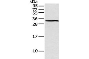 Gel: 12 % SDS-PAGE, Lysate: 40 μg, Lane: Mouse pancreas tissue, Primary antibody: ABIN7128589(ATP4B Antibody) at dilution 1/250 dilution, Secondary antibody: Goat anti rabbit IgG at 1/8000 dilution, Exposure time: 1 minute (ATP4b Antikörper)