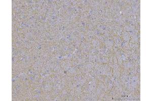 IHC analysis of WDR7 using anti-WDR7 antibody (ABIN7600939).