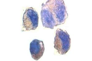 Immunocytochemical staining of K562 cells with ADAM10 antibody at 2ug/ml. (ADAM10 Antikörper)