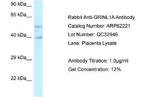 Western Blotting (WB) image for anti-Glutamate Receptor, Ionotropic, N-Methyl D-Aspartate-Like 1A (GRINL1A) (C-Term) antibody (ABIN2789069) (POLR2M Antikörper  (C-Term))