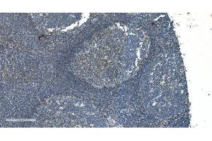 IHC analysis of TIMM8A/DDP using anti-TIMM8A/DDP antibody (ABIN7600039). (TIMM8A/DDP Antikörper  (AA 14-97))