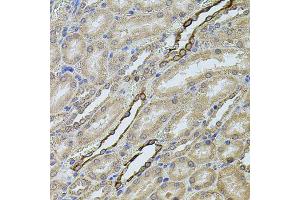 Immunohistochemistry of paraffin-embedded rat kidney using CHRFAM7A antibody (ABIN5975203) at dilution of 1/100 (40x lens).
