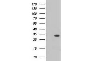 HEK293T cells were transfected with the pCMV6-ENTRY control (Left lane) or pCMV6-ENTRY MIOX (Right lane) cDNA for 48 hrs and lysed. (MIOX Antikörper)