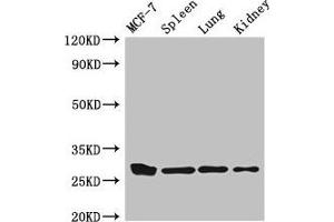 Western Blot Positive WB detected in: MCF-7 whole cell lysate, Mouse spleen tissue, Mouse lung tissue, Mouse kidney tissue All lanes: CMA1 antibody at 3 μg/mL Secondary Goat polyclonal to rabbit IgG at 1/50000 dilution Predicted band size: 28, 15 kDa Observed band size: 28 kDa (CMA1 Antikörper  (AA 22-247))