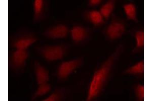 Immunofluorescence staining of methanol-fixed HeLa cells using GATA1 (phospho-Ser310) antibody (E011042, Red) (GATA1 Antikörper  (pSer310))