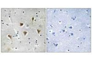 Immunohistochemistry analysis of paraffin-embedded human brain tissue using MTERF antibody. (MTERF Antikörper)