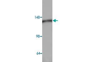 Western blot analysis of HeLa cell lysate with AP3D1 polyclonal antibody  at 1:500 dilution. (AP3D1 Antikörper)
