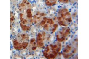 Used in DAB staining on fromalin fixed paraffin-embedded Kidney tissue (BMP6 Antikörper  (AA 375-513))