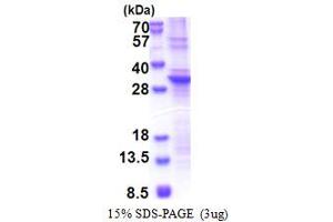 SDS-PAGE (SDS) image for Src-like-adaptor 2 (SLA2) (AA 1-261) protein (His tag) (ABIN5853434) (SLAP2 Protein (AA 1-261) (His tag))