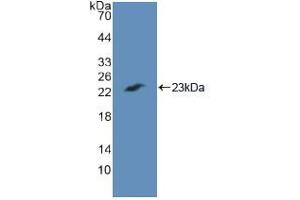 Western blot analysis of recombinant Human CASP7. (Caspase 7 Antikörper  (AA 24-198))