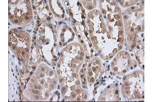 Image no. 6 for anti-Acetyl-CoA Acetyltransferase 2 (ACAT2) antibody (ABIN1496402) (ACAT2 Antikörper)