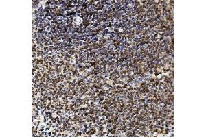 IHC analysis of U2AF2 using anti-U2AF2 antibody (ABIN7600793).