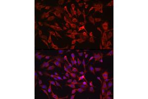Immunofluorescence (IF) image for anti-RAS Guanyl Releasing Protein 1 (Calcium and DAG-Regulated) (RASGRP1) (AA 598-797) antibody (ABIN6146720)