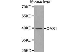 Western blot analysis of extracts of mouse liver, using OAS1 antibody (ABIN5971361) at 1/1000 dilution. (OAS1 Antikörper)