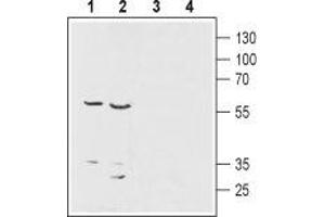 Western Blotting (WB) image for anti-Solute Carrier Family 29 (Nucleoside Transporters), Member 1 (SLC29A1) (AA 245-260) antibody (ABIN7043710)
