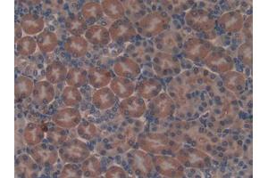 DAB staining on IHC-P; Samples: Mouse Kidney Tissue (Non Metastatic Cells 6, Protein Expressed In (AA 1-184) Antikörper)