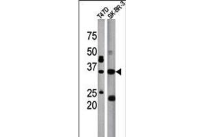 Antibody is used in Western blot to detect ICMT in T47D (left) and SK-BR-3 (right) tissue lysate