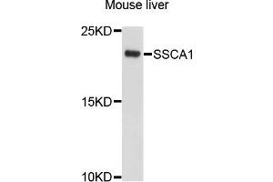 Western blot analysis of extracts of mouse liver cells, using SSSCA1 antibody. (SSSCA1 Antikörper)