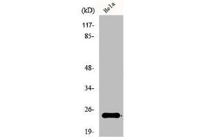 Western Blot analysis of COLO205 cells using Ephrin-A2 Polyclonal Antibody (Ephrin A2 Antikörper  (N-Term))