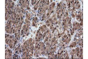 Image no. 2 for anti-Alcohol Dehydrogenase 1B (Class I), beta Polypeptide (ADH1B) antibody (ABIN1496479) (ADH1B Antikörper)