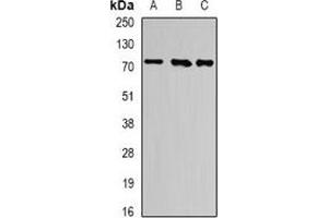 Western blot analysis of ATF6 expression in K562 (A), PC3 (B), mouse heart (C) whole cell lysates. (ATF6 Antikörper)