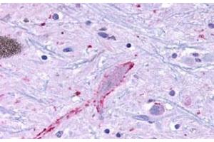 Immunohistochemical (Formalin/PFA-fixed paraffin-embedded sections) staining in human brain, neurons and glia with MRGF polyclonal antibody . (Mrgprf Antikörper  (C-Term))