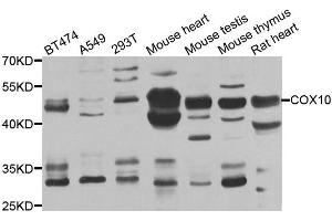 Western blot analysis of extracts of various cell lines, using COX10 antibody. (COX10 Antikörper)