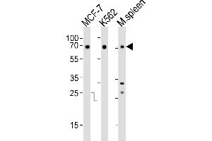 Western blot analysis of lysates from MCF-7, K562 cell line and mouse spleen tissue(from left to right), using RBBP5 Antibody (C-term) (ABIN6242596 and ABIN6577711). (RBBP5 Antikörper  (C-Term))