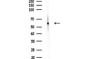 Western blot analysis of lysates from Rat lung, using SLC30 Antibody at 1/1000 dilution.
