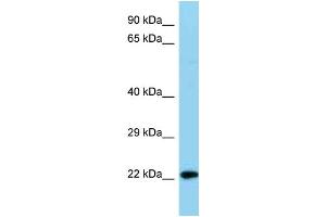 WB Suggested Anti-Ndufb8 Antibody   Titration: 1. (NDUFB8 Antikörper  (C-Term))