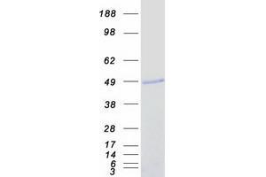 Western Blotting (WB) image for Neurogenic Differentiation 2 (NEUROD2) protein (Myc-DYKDDDDK Tag) (ABIN2727121)