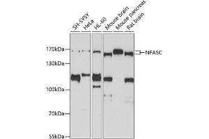 Western blot analysis of extracts of various cell lines, using NFASC antibody (ABIN3017266, ABIN3017267, ABIN3017268 and ABIN6220017) at 1:1000 dilution. (NFASC Antikörper  (AA 830-1100))
