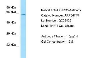 Western Blotting (WB) image for anti-Thioredoxin Reductase 3 (TXNRD3) (Middle Region) antibody (ABIN2789949) (TXNRD3 Antikörper  (Middle Region))