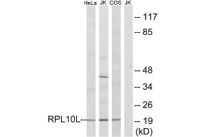 Western Blotting (WB) image for anti-Ribosomal Protein L10L (RPL10L) (C-Term) antibody (ABIN1850609) (RPL10L Antikörper  (C-Term))
