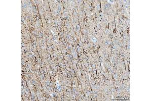 IHC analysis of Alpha Internexin using anti-Alpha Internexin antibody (ABIN4886634). (INA Antikörper  (AA 71-161))