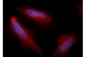 Immunofluorescence (IF) image for anti-Heparin-Binding EGF-Like Growth Factor (HBEGF) (AA 63-148) antibody (APC) (ABIN5567174)