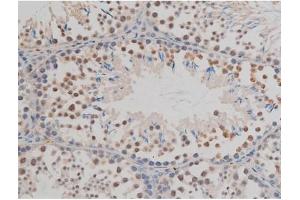 ABIN6267377 at 1/200 staining Mouse testis tissue sections by IHC-P. (GFAP Antikörper  (pSer38))