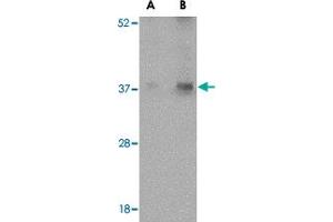 Western blot analysis of EMD in human skeletal muscle tissue lysate with EMD polyclonal antibody  at (A) 0. (Emerin Antikörper  (N-Term))