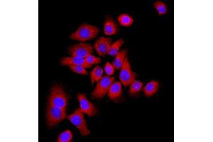 MCF-7 cells were stained with P21 Polyclonal Antibody, Unconjugated at 1:500 in PBS and incubated for two hours at 37°C followed by Goat Anti-Rabbit IgG (H+L) Cy3 conjugated secondary antibody. (p21 Antikörper  (AA 21-100))