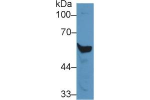Rabbit Capture antibody from the kit in WB with Positive Control: Mouse liver lysate.