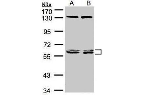 DNAJC7 Antikörper  (Center)