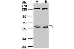 DNAJC7 抗体  (Center)