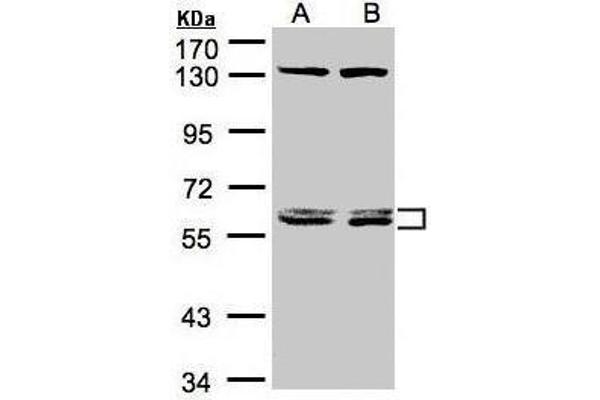 DNAJC7 抗体  (Center)
