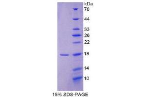 SDS-PAGE (SDS) image for Ionized Calcium-binding Adapter Molecule 1 (IBA1) (AA 1-147) protein (His tag) (ABIN1821698) (Iba1 Protein (AA 1-147) (His tag))