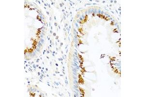 Immunohistochemistry of paraffin-embedded human colon using FB antibody (ABIN3021390, ABIN3021391, ABIN3021392 and ABIN6215001) at dilution of 1:100 (40x lens). (FAM3B Antikörper  (AA 30-235))