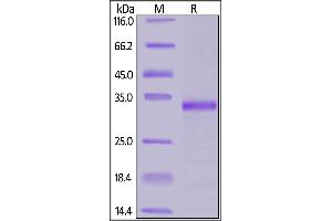 SDS-PAGE (SDS) image for Janus Kinase 1 (JAK1) (AA 561-852) protein (His tag) (ABIN7013428)